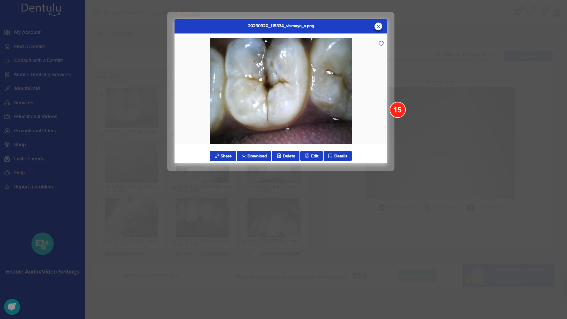 mouthcam instructions