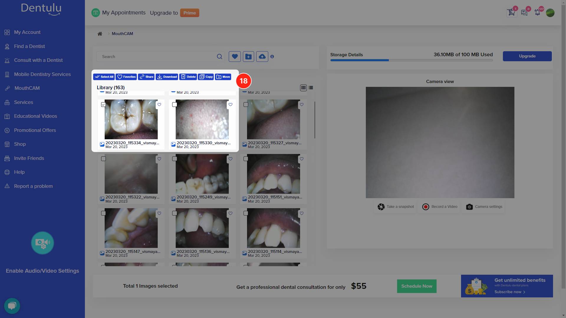 mouthcam instructions