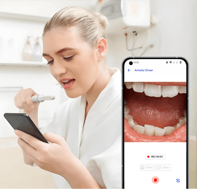 MouthCAM Mobile Banner