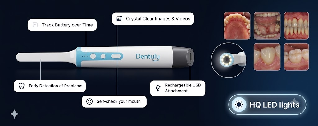 Mouth Cameras