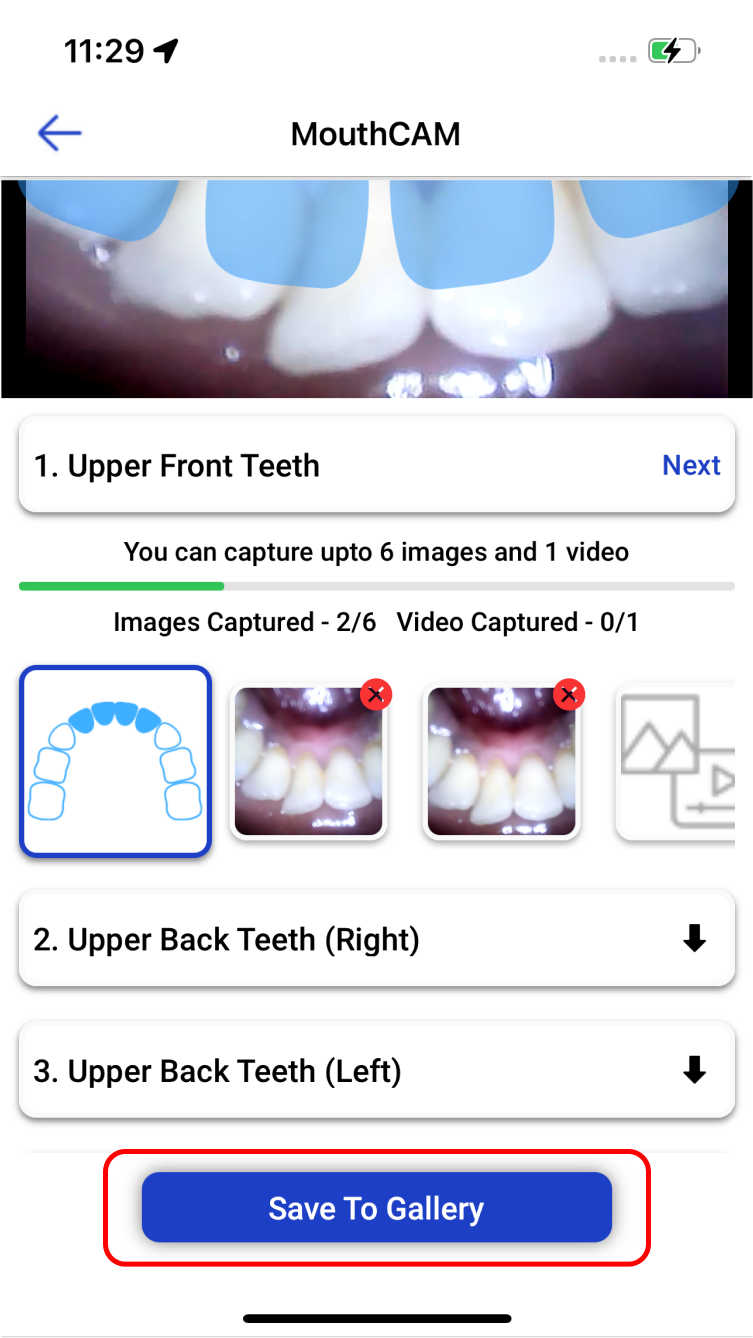 mouthcam instructions