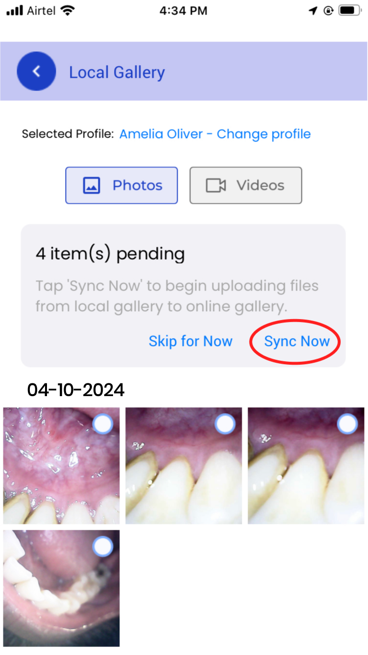 mouthcam instructions