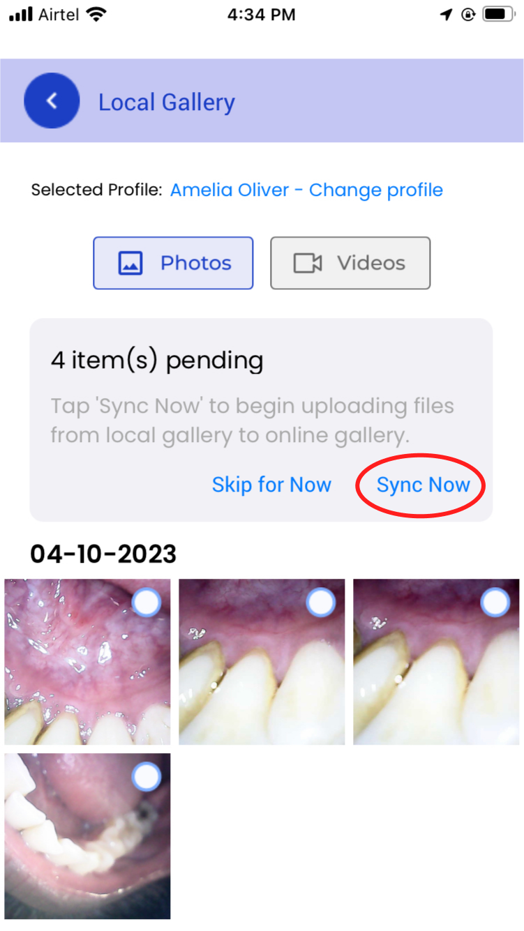 mouthcam instructions