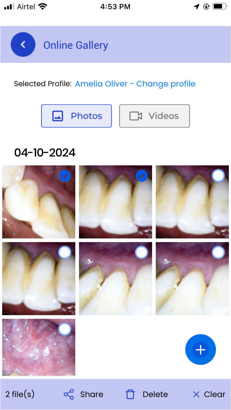 mouthcam instructions