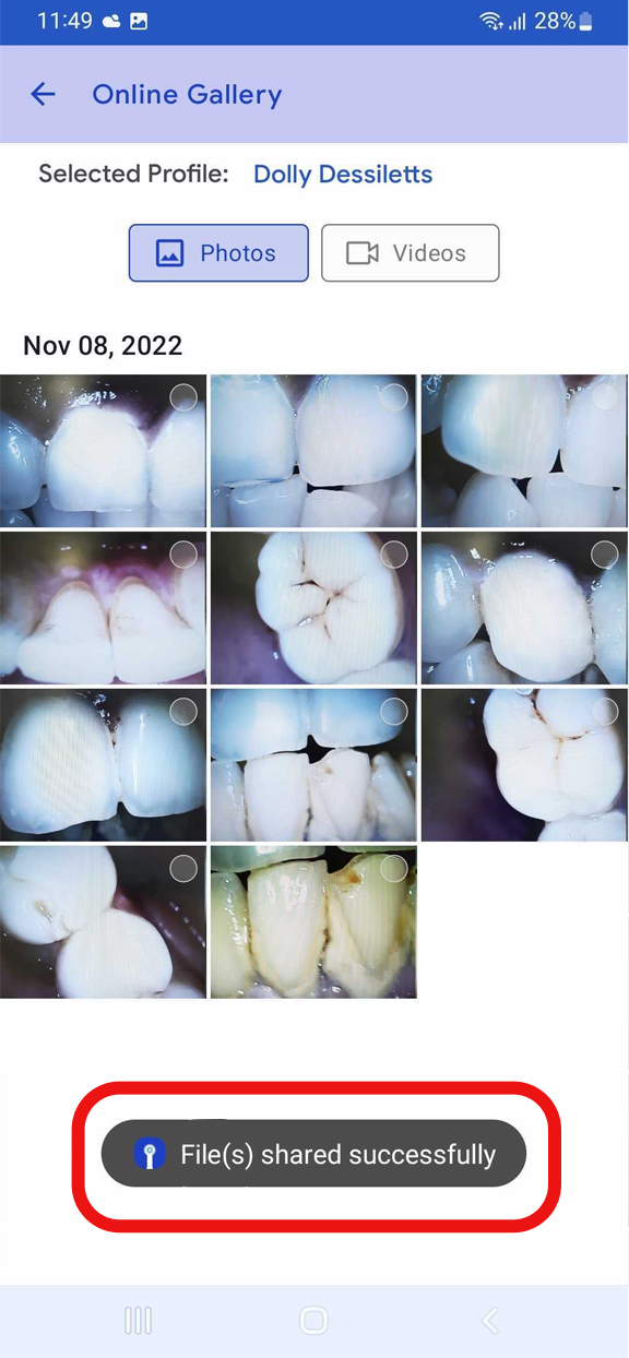 mouthcam instructions